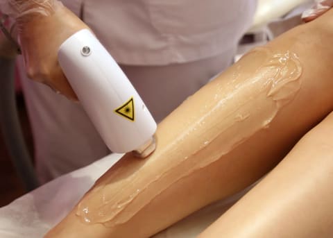Laser hair removal treatment at SKYN